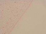 MISSING THUMBNAIL